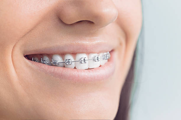 Why Choose Us for Your Dental Needs in Orange City, FL